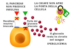 IPERGLICEMIA